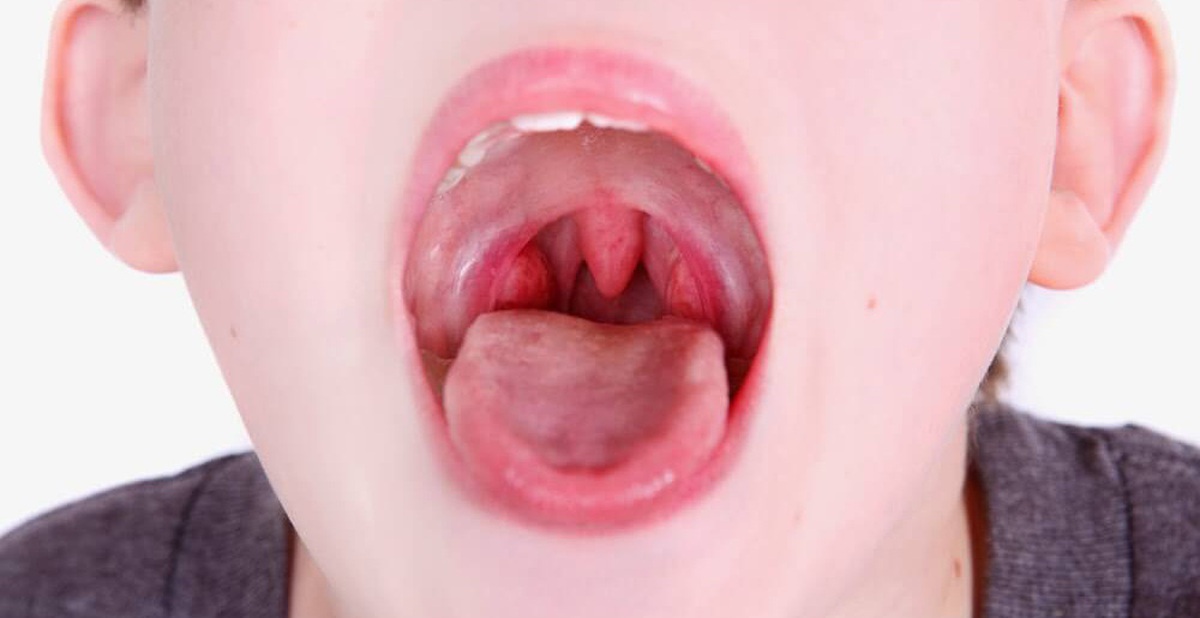 033929851df82ece4d16.jpg