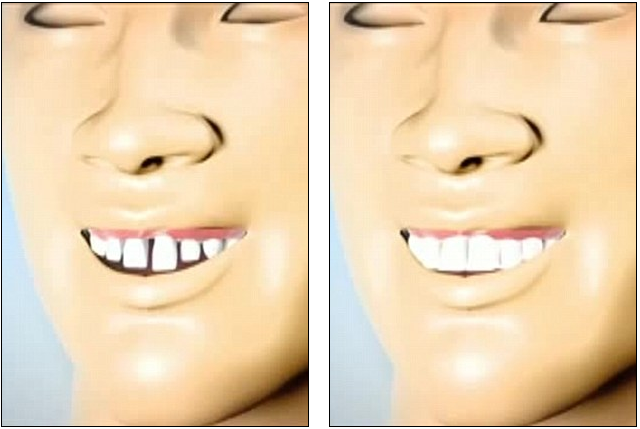 068fd1f490c3478e59b4.png