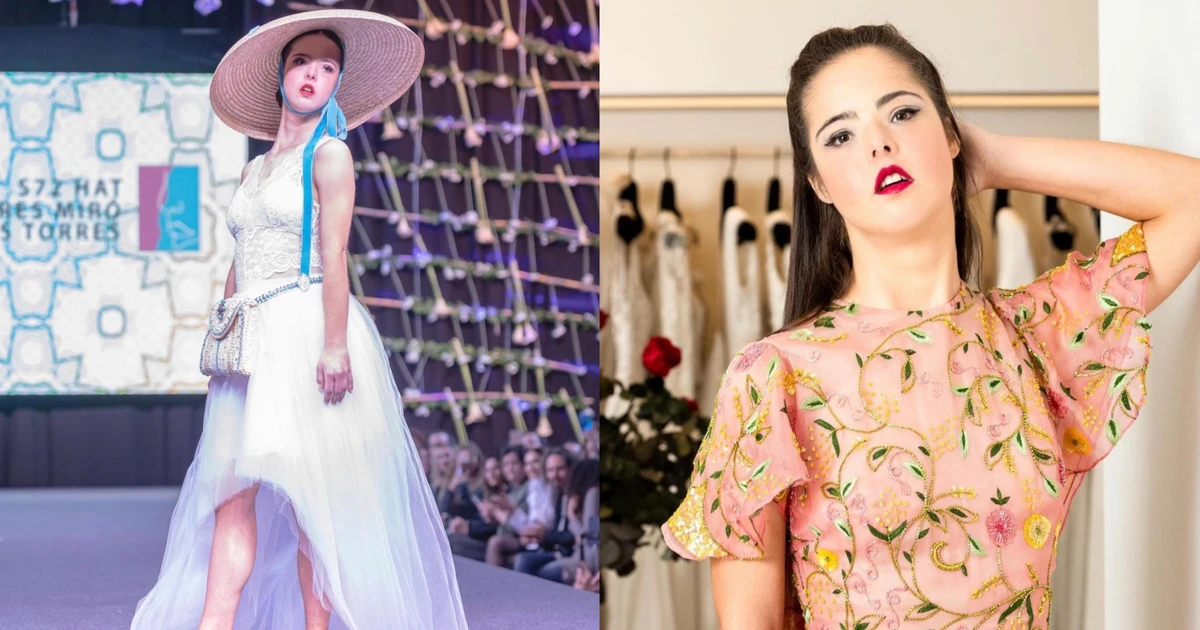 Cô gái mắc hội chứng Down chinh phục sàn catwalk quốc tế: Ai bảo khác biệt là không thể tỏa sáng? ✨
