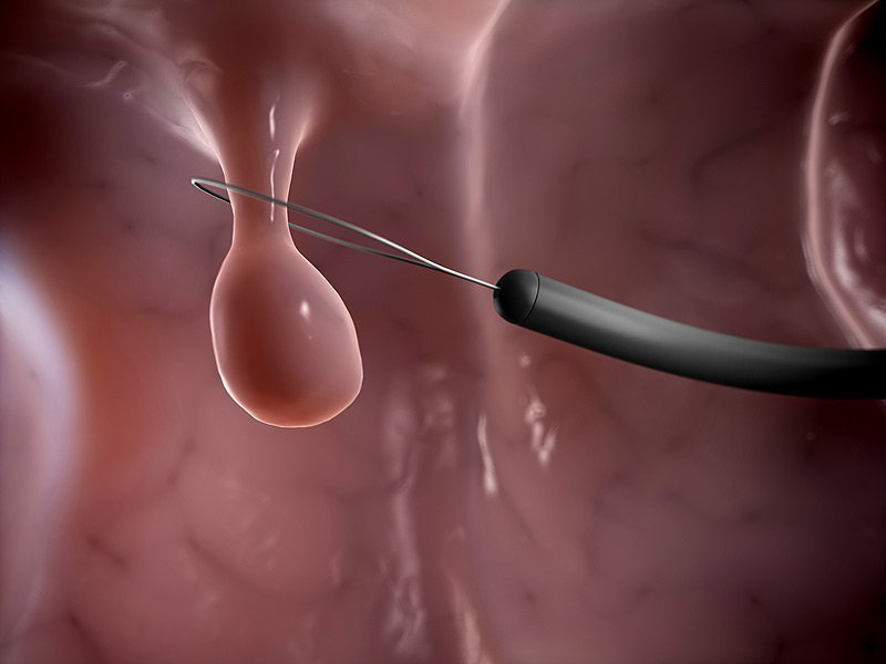 0986f77d251719e35820.jpg