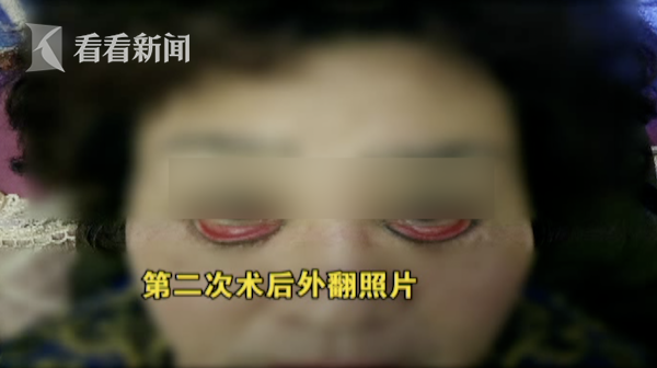 0992a38c289118b25f17.png