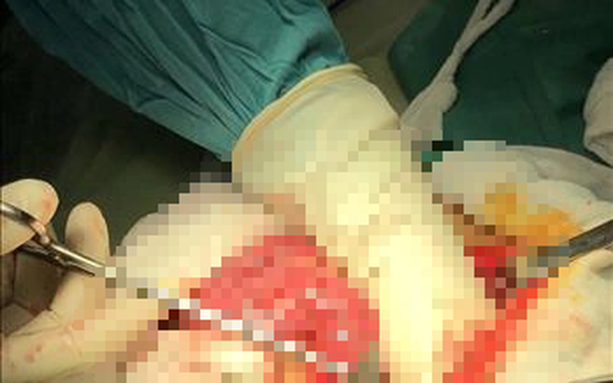 09fc76a4b625e901b80b.png