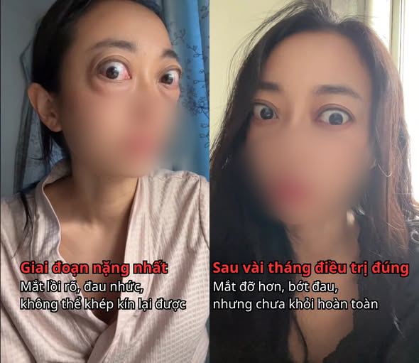 0a3b9cd2a1f530ffdbff.jpg