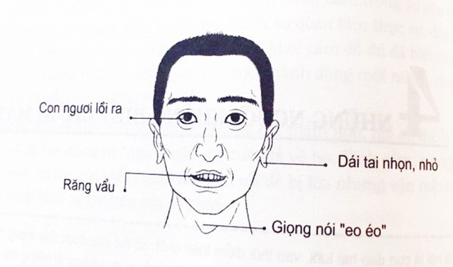 0b6e12596ea070097aae.jpg