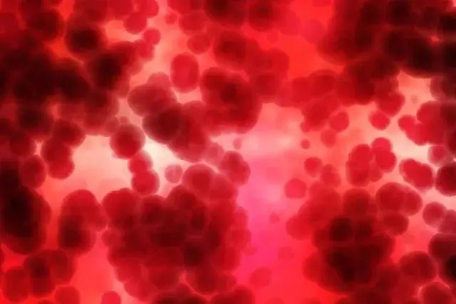 0c84b5952e870bdc370b.jpg