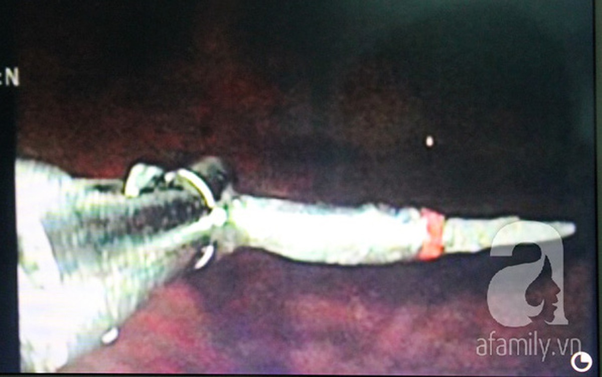 0e3dfb01749c0e681992.jpg
