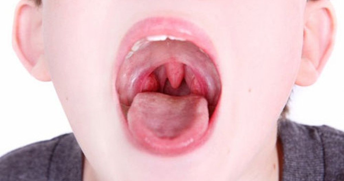 101f1213960278ae30e0.jpg