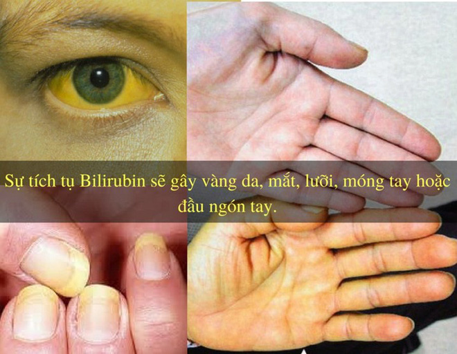 10f8f7c8a94b8d77e6d4.jpg