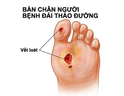 11928643905c611a2619.png