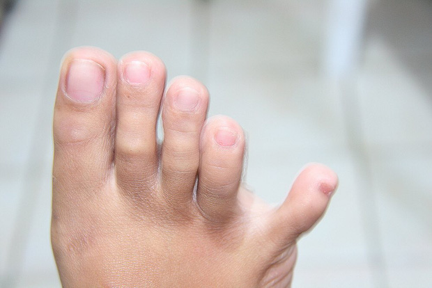 146b0cb4f86030320093.jpg
