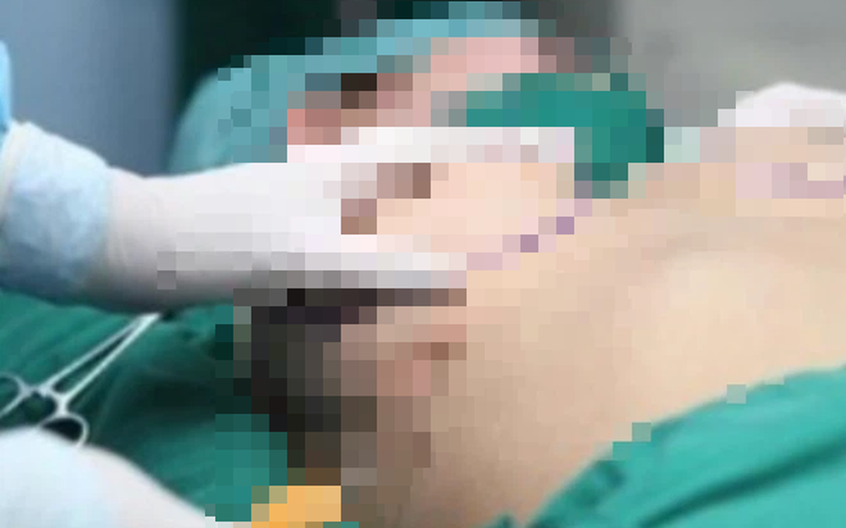 147e70b0cd8f0a369be3.png