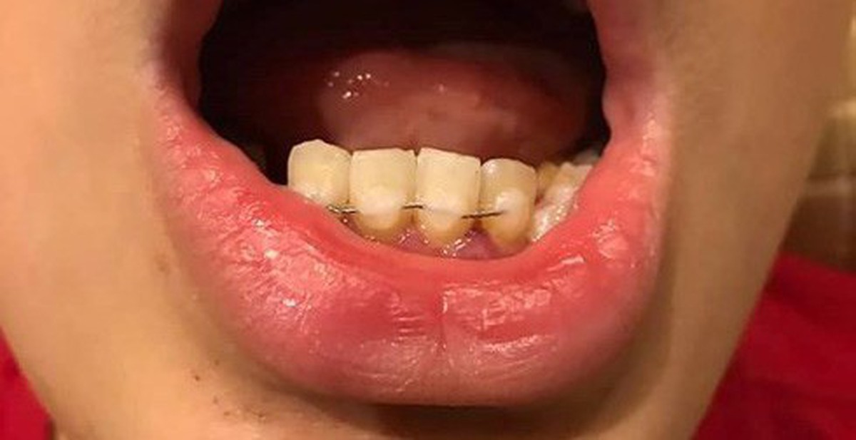 16389a155d9d670c104d.jpg