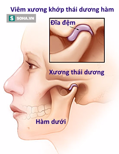 1684113b31d29c8c7498.png