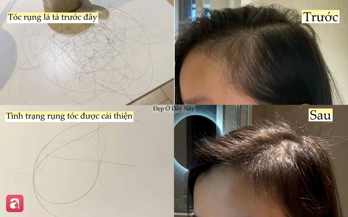 1708cca3725e0856efc6.png