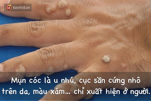 19f1e3992dbf16e187b9.jpg
