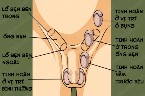1f140229c6ad79528d23.png