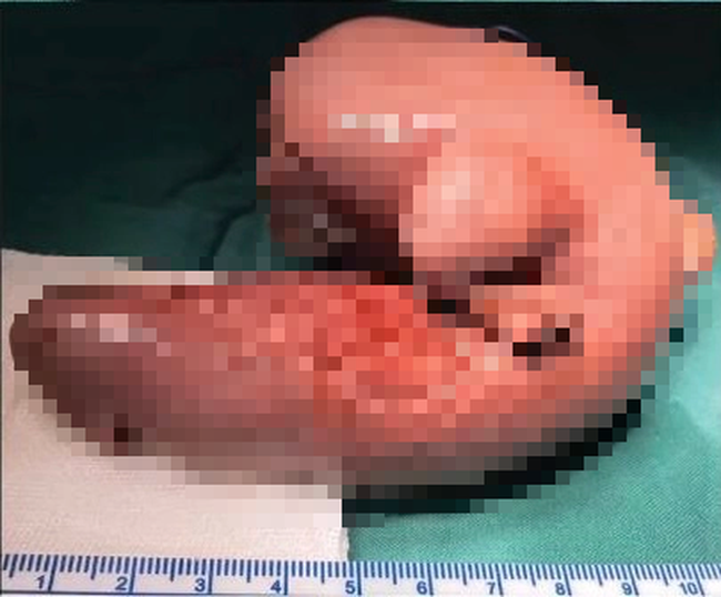 209c66d82d96192dfb45.png