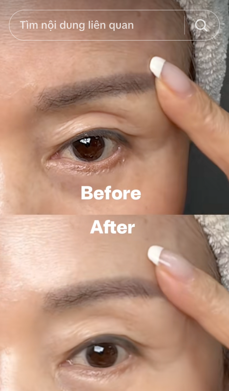 216152a71684c44beed3.png