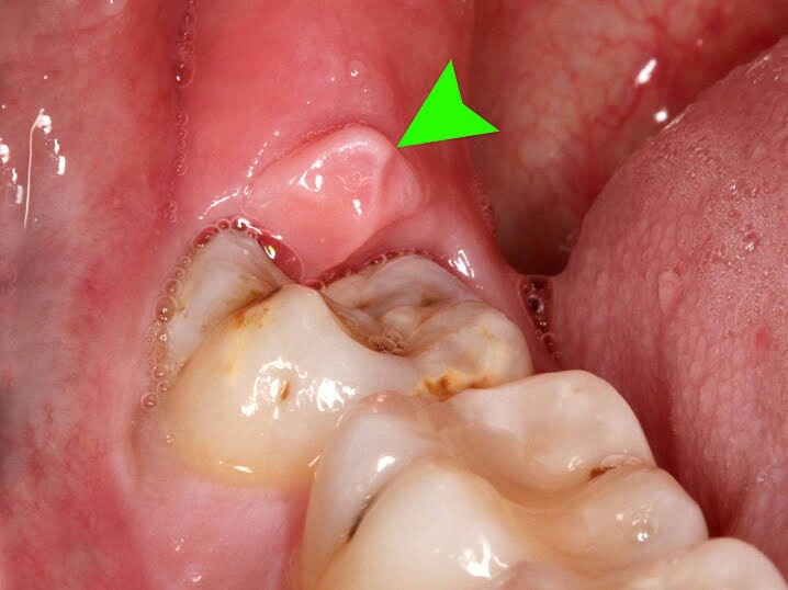 253a39fcd112a917b312.jpg