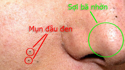 25feff3450e574dded30.jpg