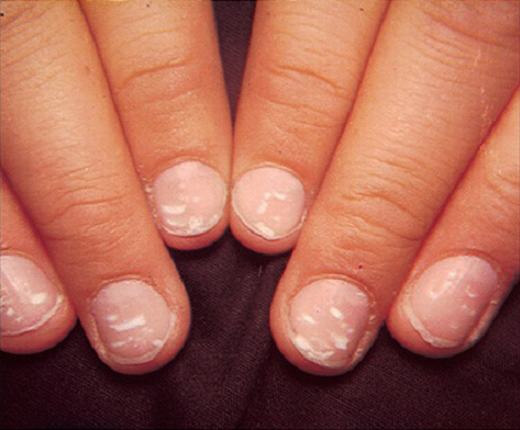 261a77d5d47614d478e6.jpg