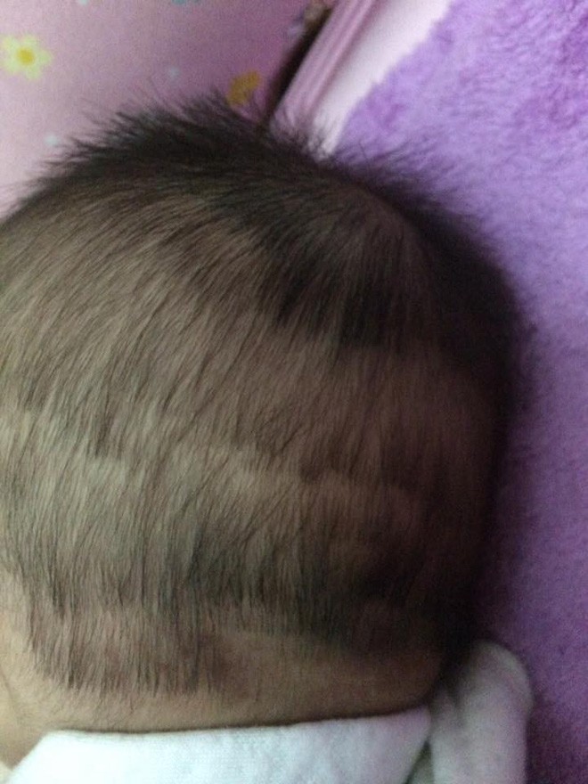 28587fd629baff33d259.jpg