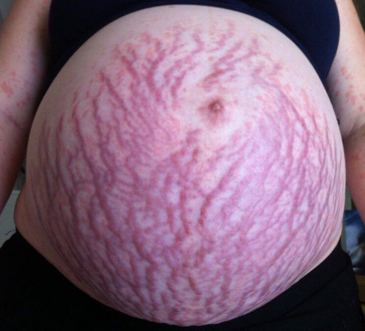 2fda85c4aa0f7c27a8ec.jpg