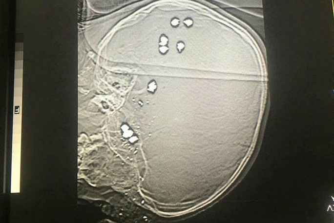 31bccc8a0173ea8c2699.jpg