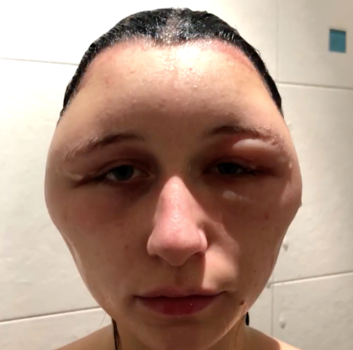 31e17bddcb24fa61c123.png
