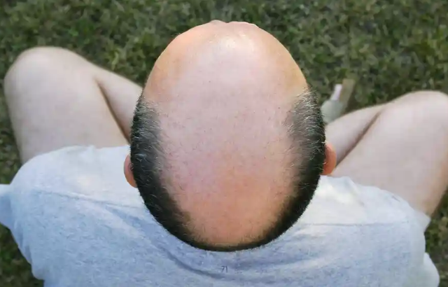 3360694b3ce4b7dea5d3.png