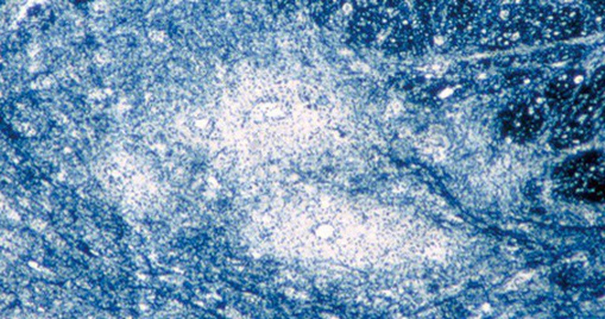 3bee22d0361f8402712e.jpg