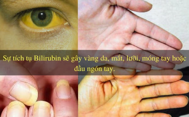 48f918d6bf057b98422c.jpg
