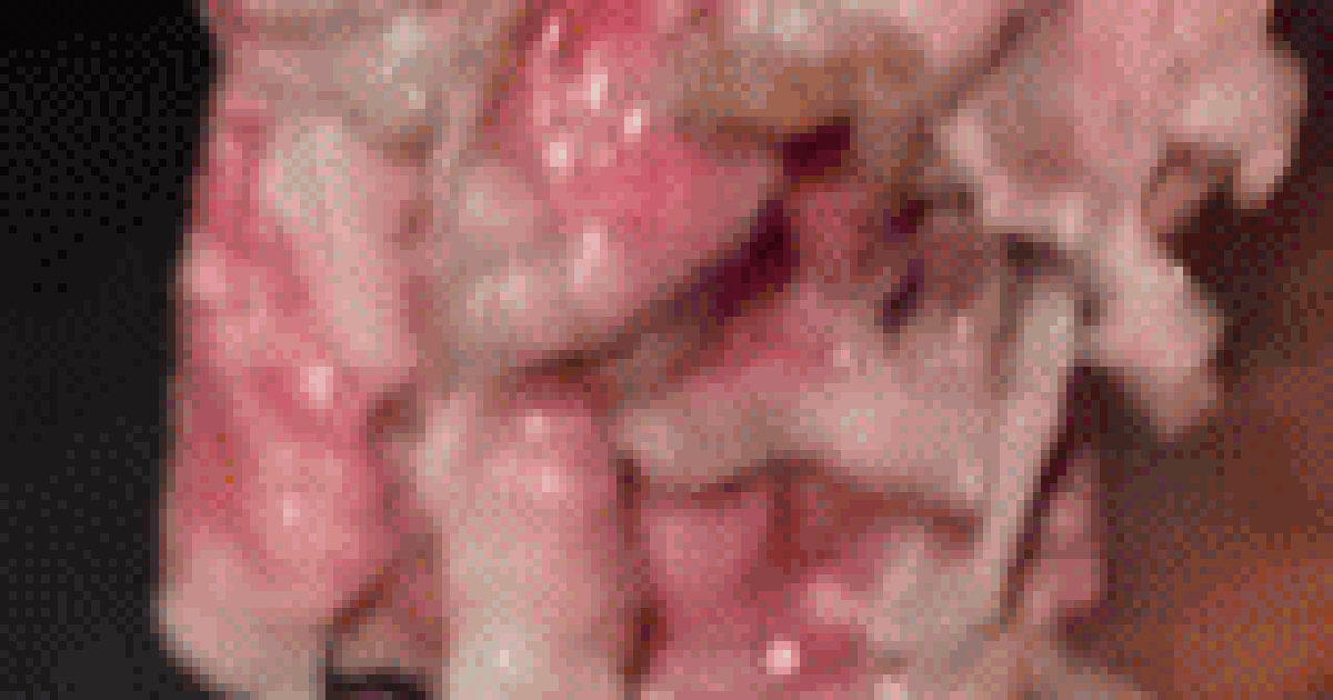 53131e1bb28af4263705.png