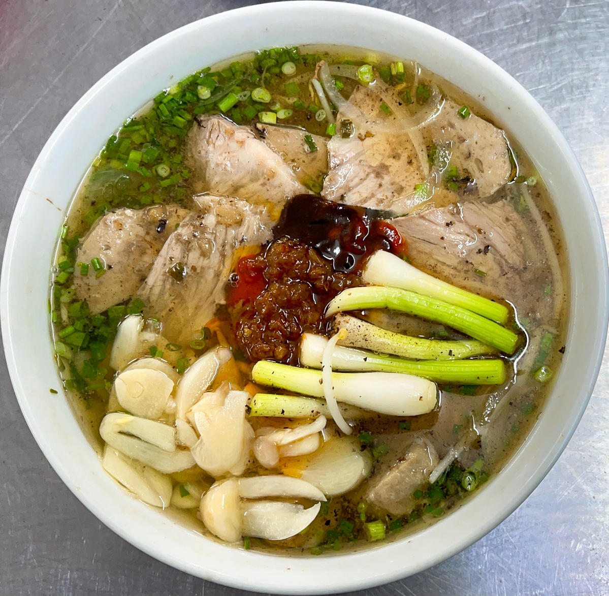 Bệnh quá ăn cho hồi sức - Khi anh hàng xóm "nạp năng lượng" đến mức thận phải kêu cứu