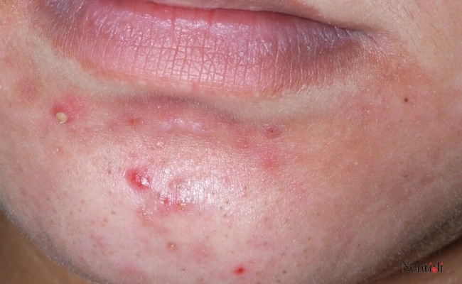 5ea9ca18498bad77d954.jpg