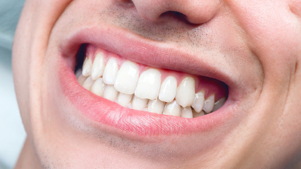 62f984f5f450e58c6914.jpg