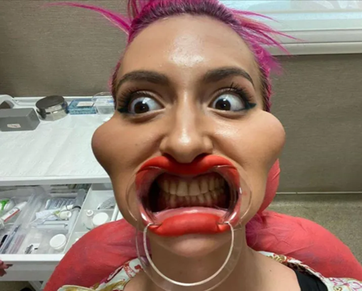 6461169c7755680a2a42.png