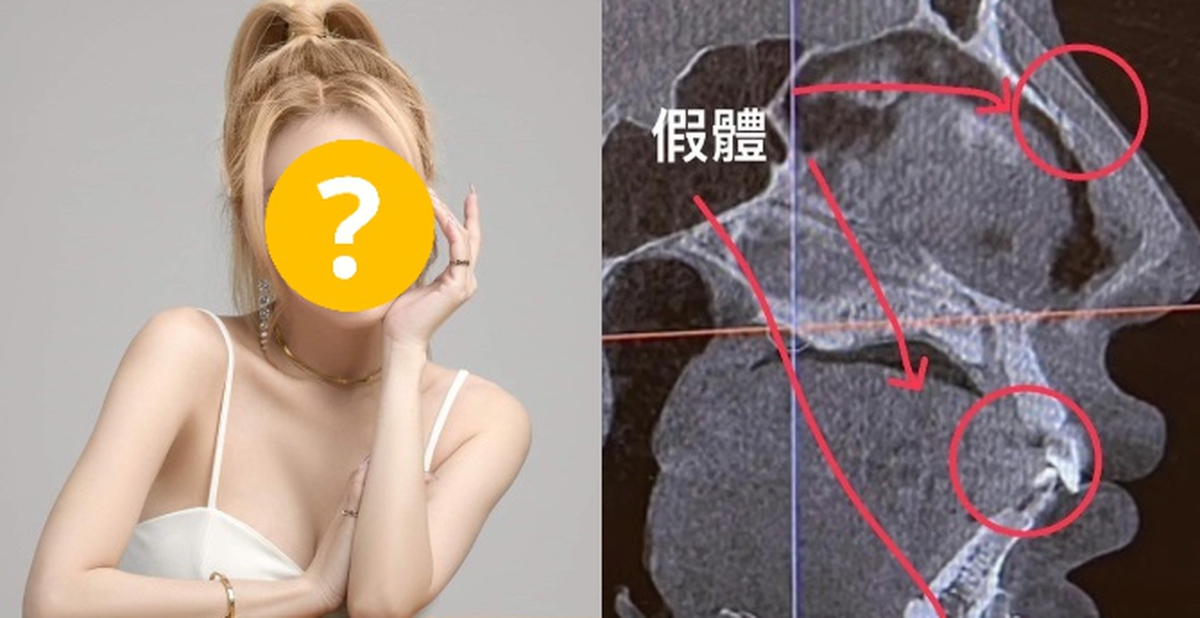 66448a1626159a9911db.jpg