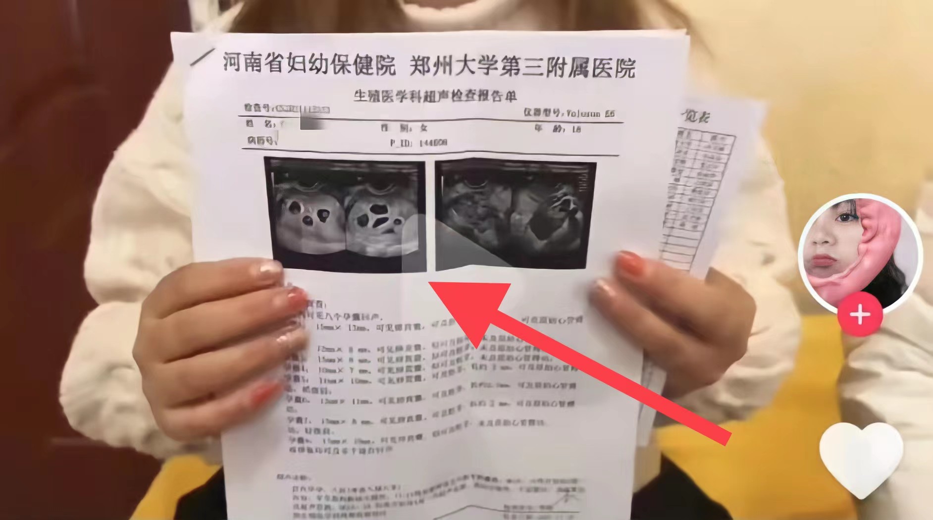 66671ec40db8ddaa2103.jpg