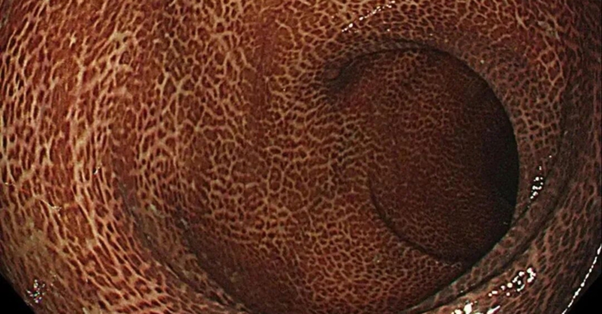6c243f7dfc034e7c1005.jpg