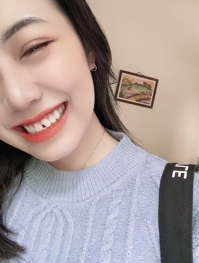 70e199620f3de44f235f.png