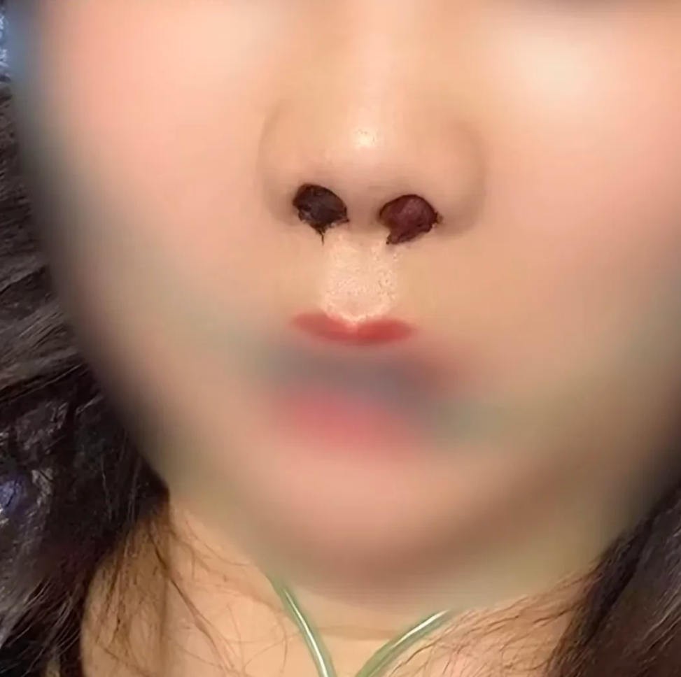 771a5ca9420cb3a753ab.png