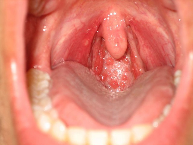 7a8977014daf0079ade7.jpg