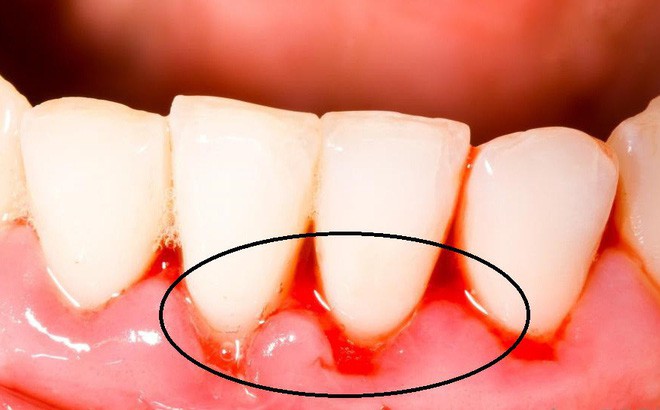 7e72dce21474eae5da78.jpg