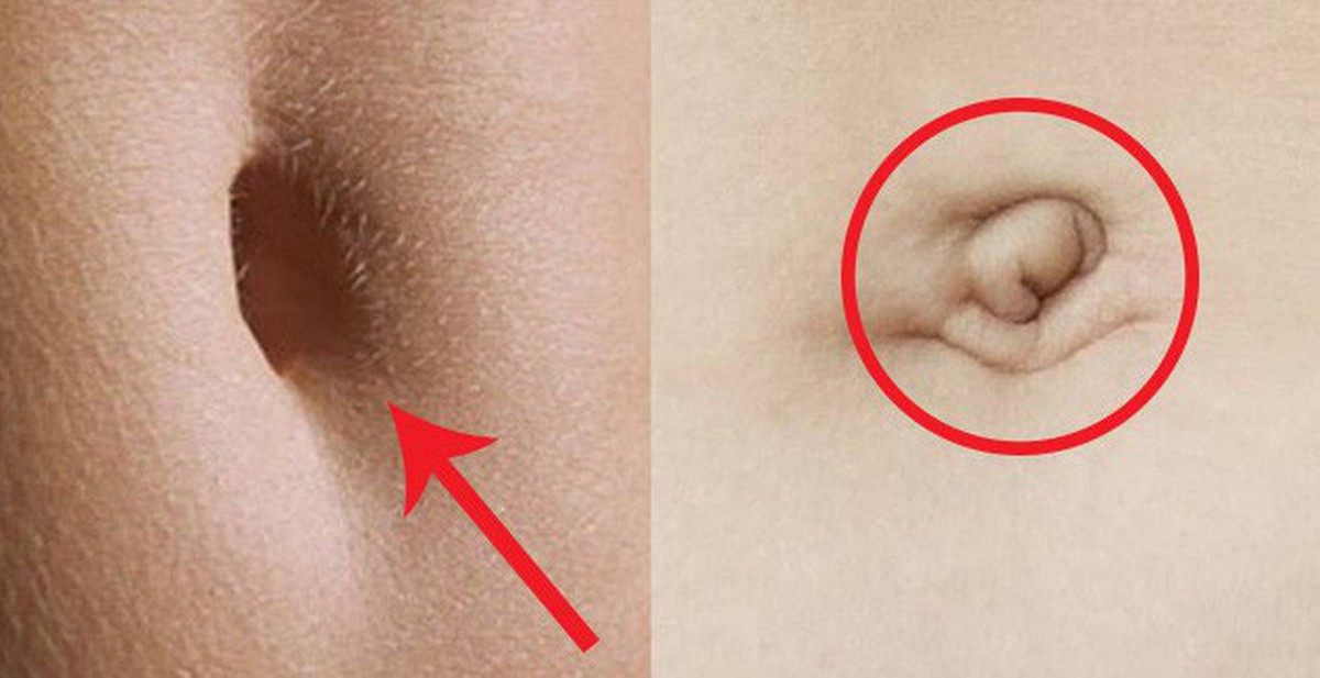 7ef0fd3f8461aeff9c41.jpg