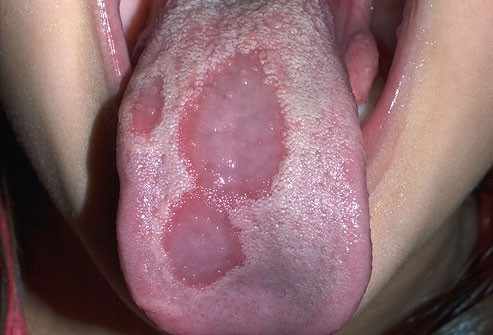 82ea63cb8317b23f4d14.jpg