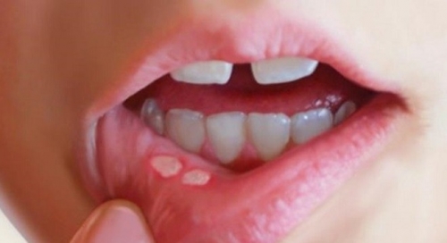 8538b4d3254bb0c38399.jpg