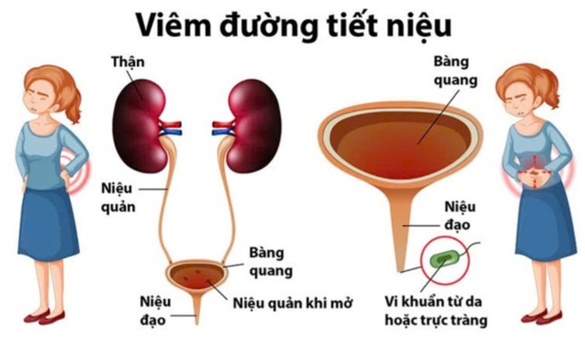 87a5d1dc8c3e0acfaf33.jpg