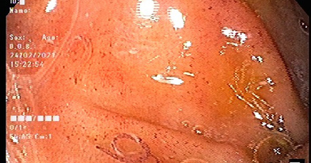 8b644aefc06723563d4a.jpg