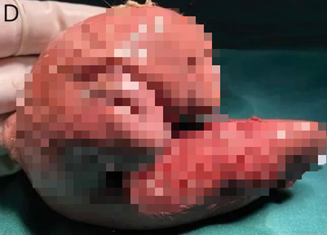 8da0a631b33dc3f082ef.png